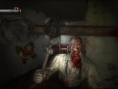 Condemned : des images malsaines