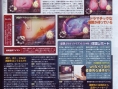 Trauma Center : le remake Wii