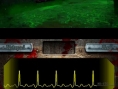 Dementium : 37 images
