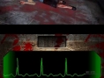 Dementium : 37 images