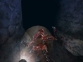 Dementium II : des images dans le noir