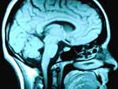 Mind Quiz